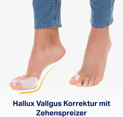 Hallux Valgus Zehenspreizer [6 Stück]