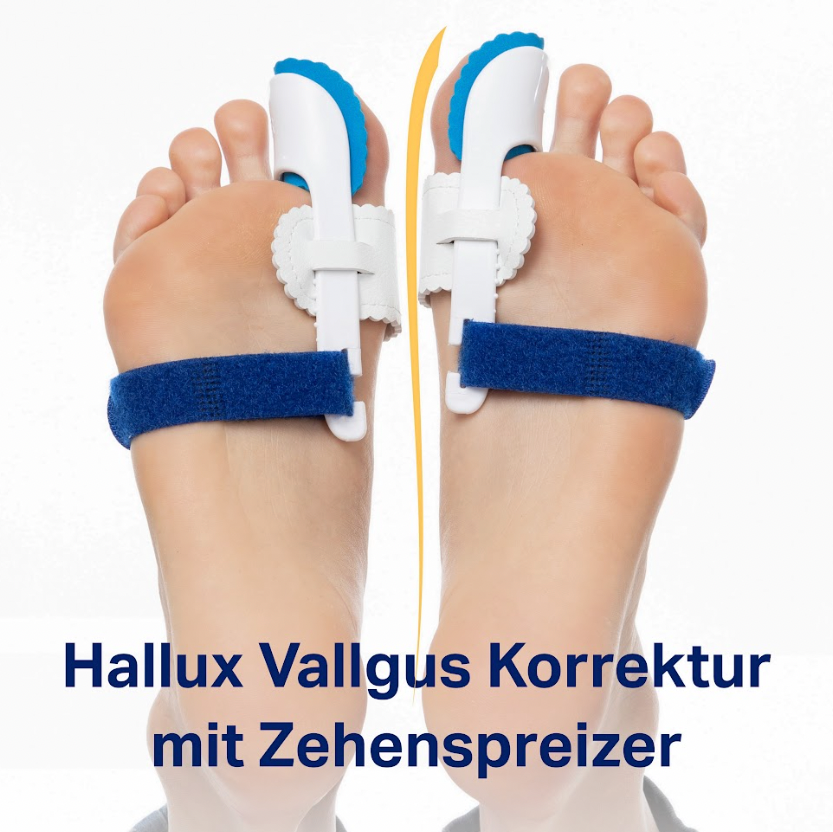 Hallux Valgus Zehenspreizer mit Schiene [4 Stück]